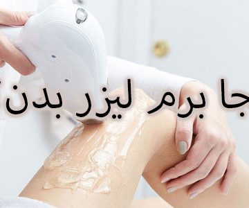لیزر بدن در کرج